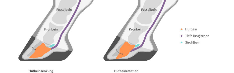 Hufbein-Schema